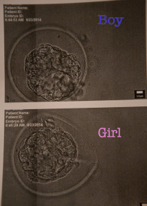 surro embryo transfer_6