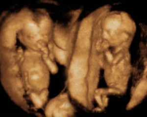 twins 14 weeks